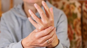 Psoriatic Arthritis Treatment Market Size, Industry Trends | Analysis 2024-2032