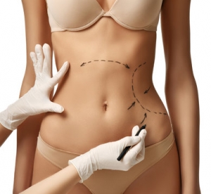 What Influences the Cost of Body Liposuction in Riyadh?