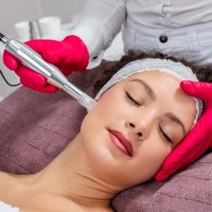 Microneedling FAQs: Answers from Islamabad Experts