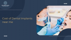 Cost of Dental Implants near me