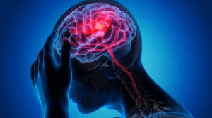 Comprehensive Neurological and Neurosurgical Care in Navi Mumbai: Understanding Symptoms and Precautions with Dr. Sunil Kutty