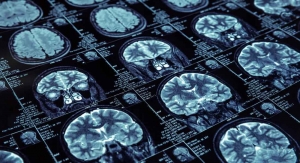 How Neuroimaging is Revolutionizing and Advertising