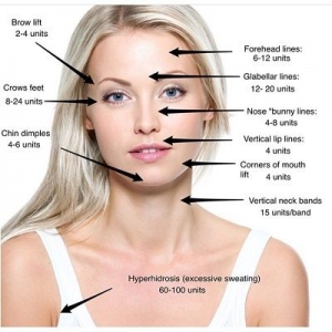 Preparing for Your Botulinum Toxin Consultation in Dubai