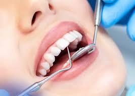 Tips for Finding a Skilled Implant Dentist