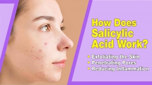 Affordable and Effective: Discovering the Top Salicylic Acid Serum in Pakistan
