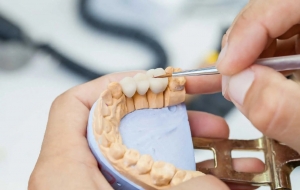 Dental Crowns: Purpose, Procedure, and Cost