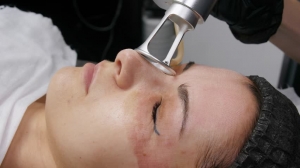 Exclusive CO2 Laser Treatments for Discerning Clients