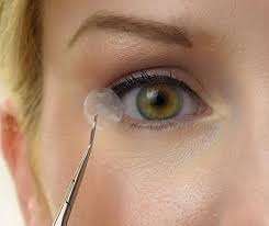 The Amniotic Membrane Market is Anticipated to Witness High Growth Owing to Rising Awareness About Its Potential Medical Applications