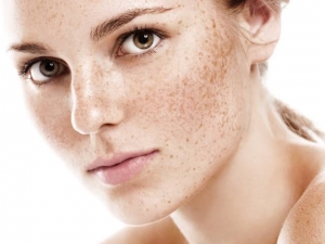 Pigmentation Removal in Dubai: What to Expect