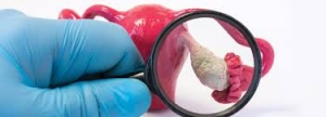 Understanding the Ways to Conduct and Determine PCOS Diagnostic