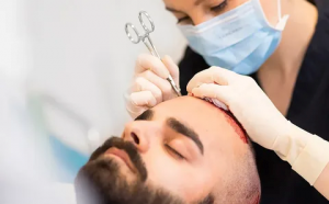 How to Choose the Right Hair Transplant Procedure in Dubai