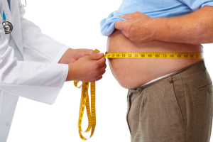 Bariatric Surgery for Weight Loss: A Comprehensive Guide