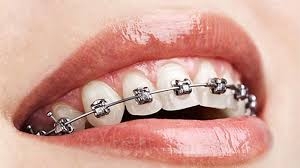 Orthodontics in Wantirna