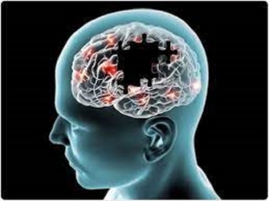 Alzheimer’s Disease Market Report 2024: Epidemiology, Industry Trends, Size, Share and Forecast to 2034