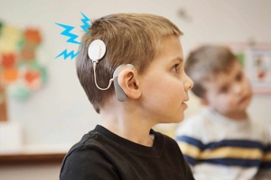 Cochlear Implants Market is Anticipated to Witness High Growth Owing to Rising Cases of Hearing Loss