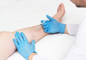 Top Questions to Ask at Your Vein Clinic Consultation