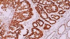 Immunohistochemistry is Transforming Medical Science and Healthcare 