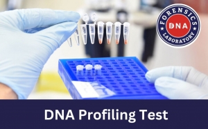 Role of DNA Profiling Test in Modern Science