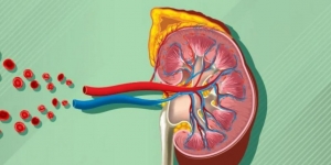 The Impact of Hypertension on Kidney Health