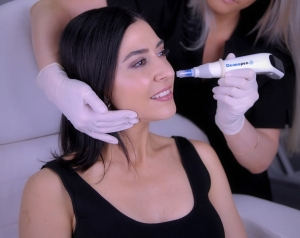 The Benefits of Dermapen Treatment for Skin Rejuvenation