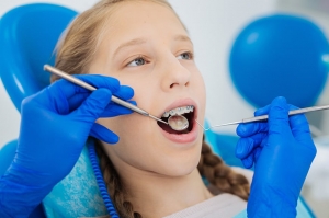 Invisible Braces: Why are They a Smart Teeth Alignment Choice?