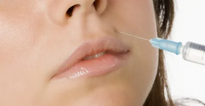 Expert Tips for Restylane Fillers in Dubai