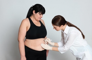 Common Myths and Misconceptions About Bariatric Surgery Debunked