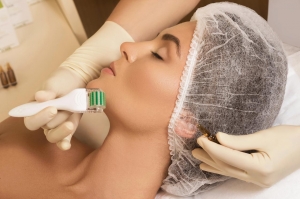 Exploring the Benefits of Microneedling for Skin Rejuvenation