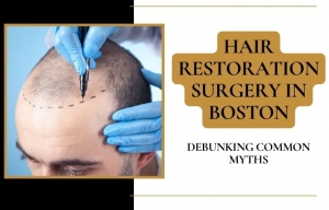 Hair Restoration Surgery in Boston: Debunking Common Myths