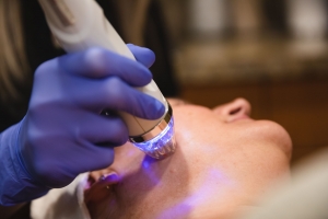 How Fractional RF Microneedling Combats Signs of Aging