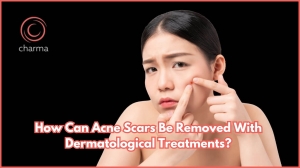 How can acne scars be removed with dermatological treatments?