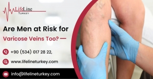 Finding the Right Varicose Veins Surgery Centre in Turkey