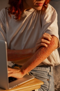  Skin Rashes  Treatment in Alexandria