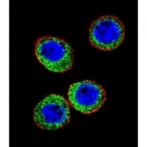 The Anti-Neprilysin Market Poised to Grow at a Robust Pace Owing to Rising Prevalence of Cardiovascular Diseases