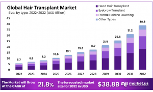 Hair Transplant Market Expansion: Opportunities in Emerging Markets and Untapped Regions