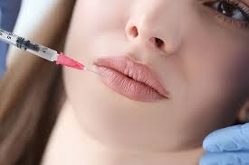 Enhancing Your Smile with Lip Fillers: Tips and Techniques