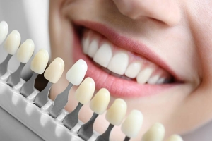 The Science of Teeth Whitening: How Modern Treatments Work