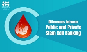 Differences between Public and Private Stem Cell Banking