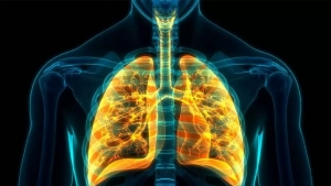 Lung Cancer Screening Who Should Get Screened and Why?