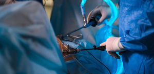 Achieve Weight Loss Success with Laparoscopic Sleeve Gastrectomy in Dubai