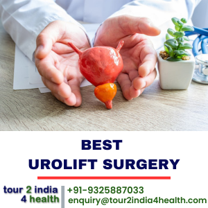 Urolift Procedure: A Breakthrough in Urological Care