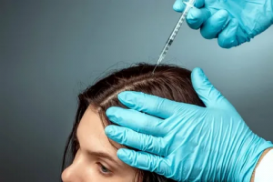 Why Plasma Injections Are Gaining Popularity in Abu Dhabi for Hair Loss
