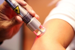 Laser Therapy Market Analysis and Forecast by Size, Share, Growth, Trends 2031