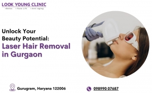 Unlock Your Beauty Potential: Laser Hair Removal in gurgaon