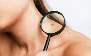 Enhance Your Overall Well-being: Mole Removal Impact