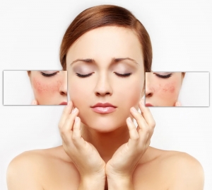 Skin Pigmentation Treatment