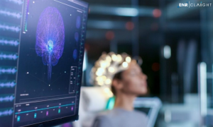 Global Neurodiagnostic and Monitoring Devices Market | Share | Size | Analysis | Growth | Forecast | 2024 - 2032