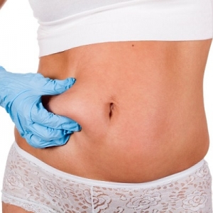 Real-Life Liposuction Success Stories: Transformations and Testimonials