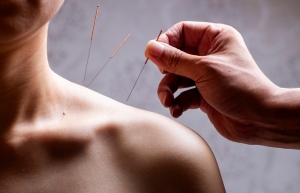 5 Things Expected During Acupuncture Treatment For Neck Pain