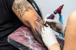 Laser Tattoo Removal Aftercare